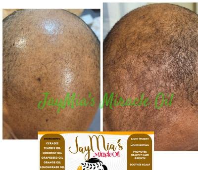 JayMia's Miracle Oil - Love Is In The Hair